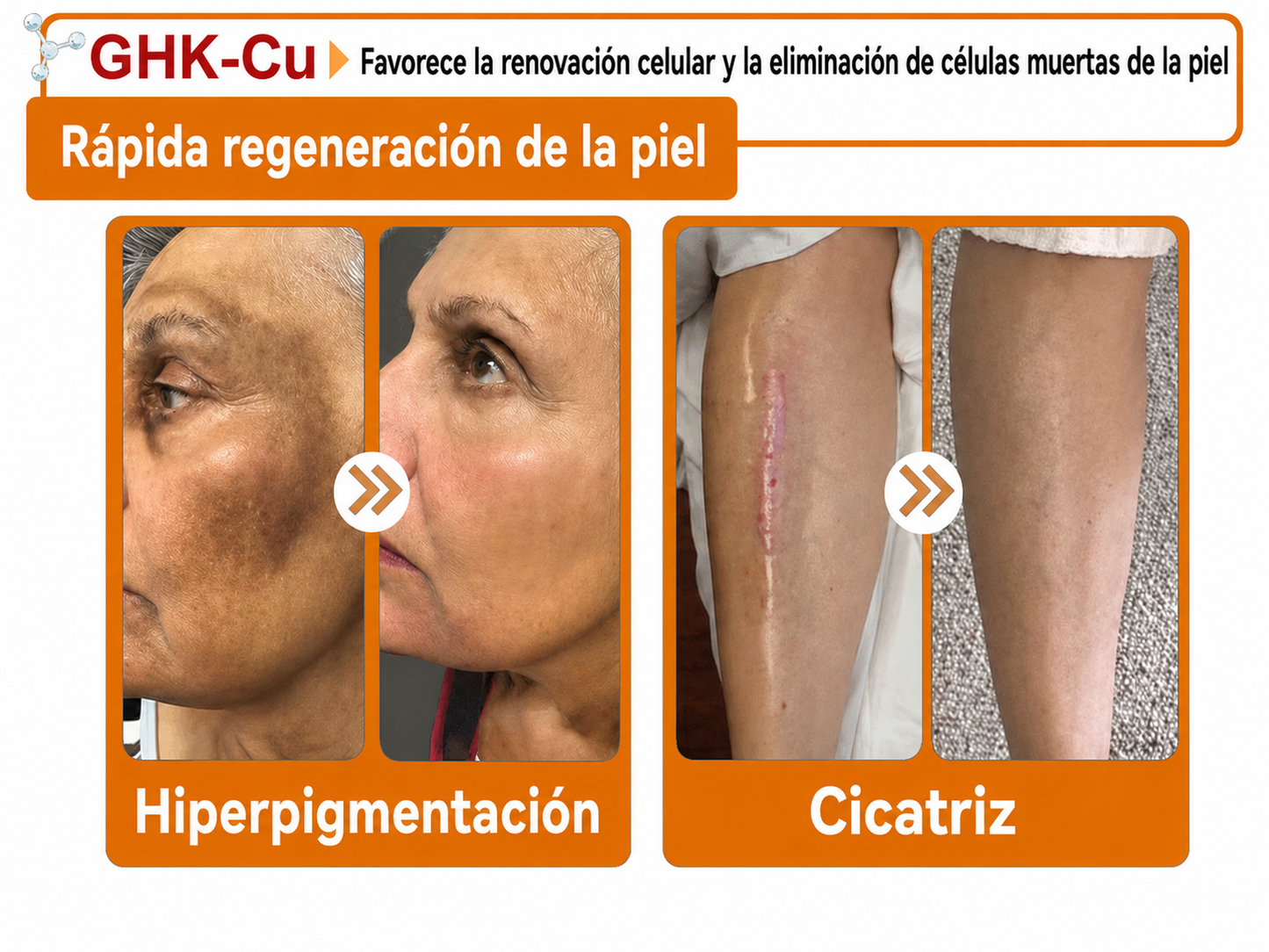 🔥🔥Versión mejorada con nuevo envase 2026丨⚡️ROLIMEY® PDRN crema roll-on multipeptídica para reafirmar, regenerar y suavizar la piel