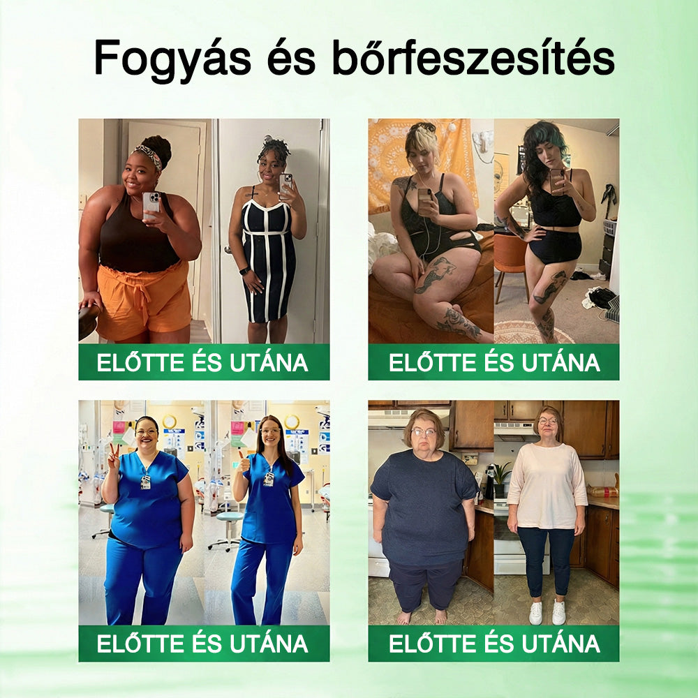 🔥GFOUK® 𝐁𝐞𝐫𝐛𝐞𝐫𝐢𝐧 · Vadgesztenye × NAD+ 10 az 1-ben Fejlett Nano Tűs Tapasz — 🍃 Naponta egyszer, 7 nap alatt látható eredmények (elhízás, laza bőr, cukorbetegség, alvási apnoe, ízületi problémák és más)🔥