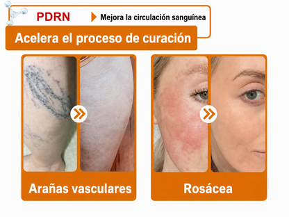 🔥🔥Versión mejorada con nuevo envase 2026丨⚡️ROLIMEY® PDRN crema roll-on multipeptídica para reafirmar, regenerar y suavizar la piel