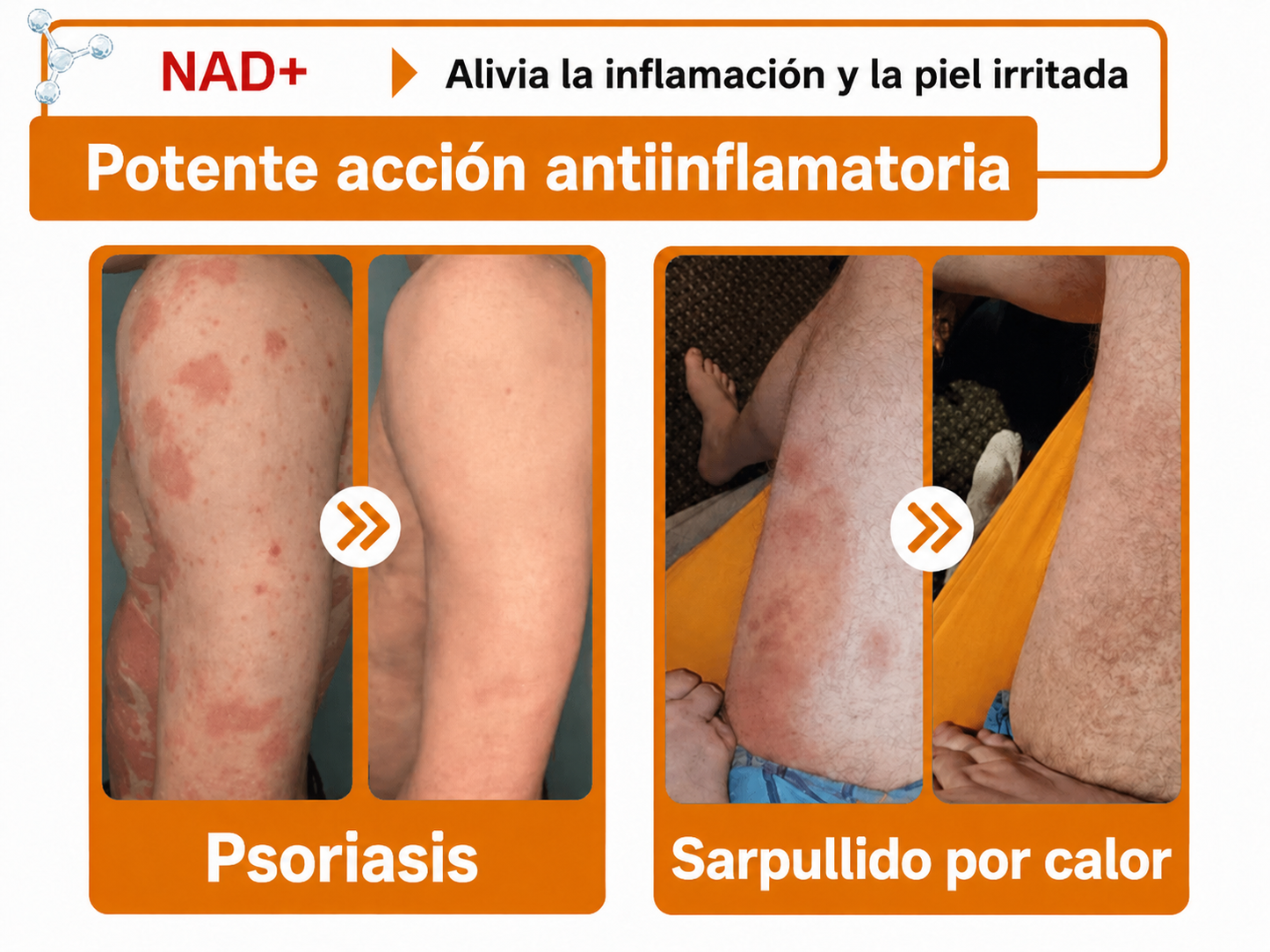 🔥🔥Versión mejorada con nuevo envase 2026丨⚡️ROLIMEY® PDRN crema roll-on multipeptídica para reafirmar, regenerar y suavizar la piel