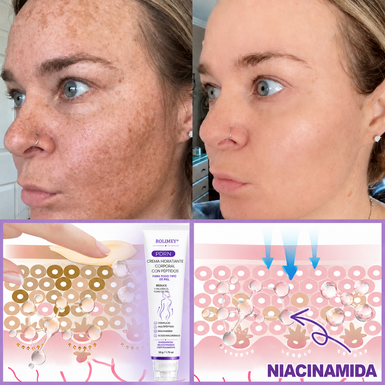🔥🔥Versión mejorada con nuevo envase 2026丨⚡️ROLIMEY® PDRN crema roll-on multipeptídica para reafirmar, regenerar y suavizar la piel