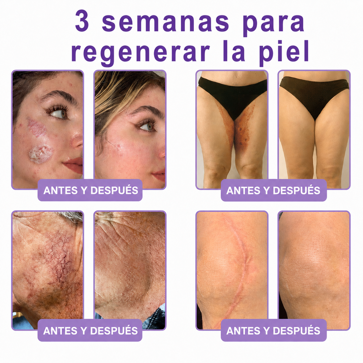 🔥🔥Versión mejorada con nuevo envase 2026丨⚡️ROLIMEY® PDRN crema roll-on multipeptídica para reafirmar, regenerar y suavizar la piel