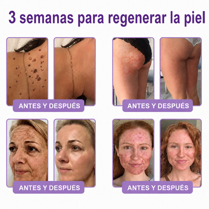 🔥🔥Versión mejorada con nuevo envase 2026丨⚡️ROLIMEY® PDRN crema roll-on multipeptídica para reafirmar, regenerar y suavizar la piel